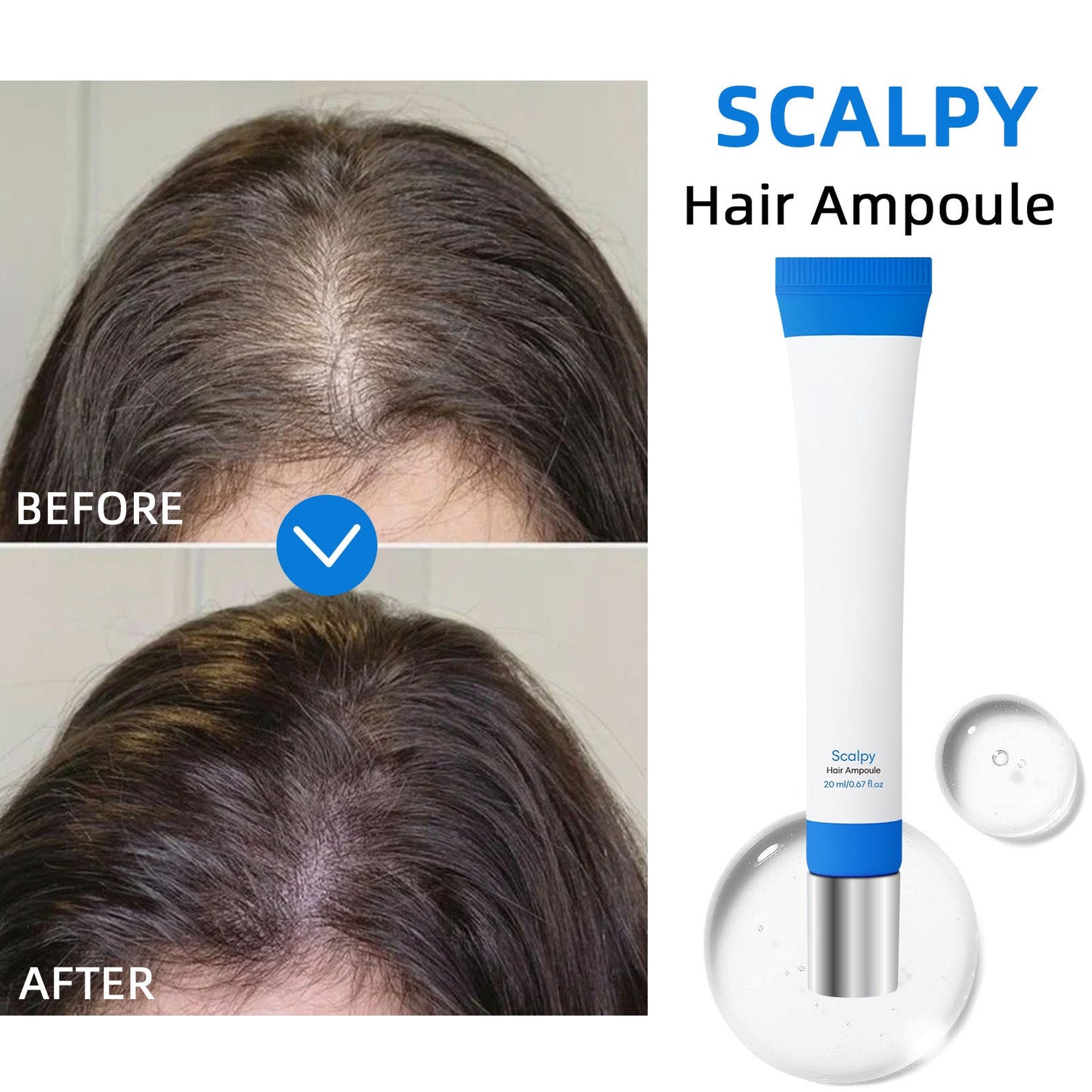 Scalpy Hair Growth Serum for Hair Loss & Thinning