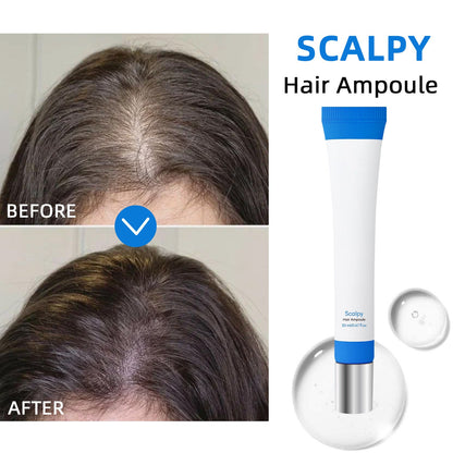 Scalpy Hair Growth Serum for Hair Loss & Thinning